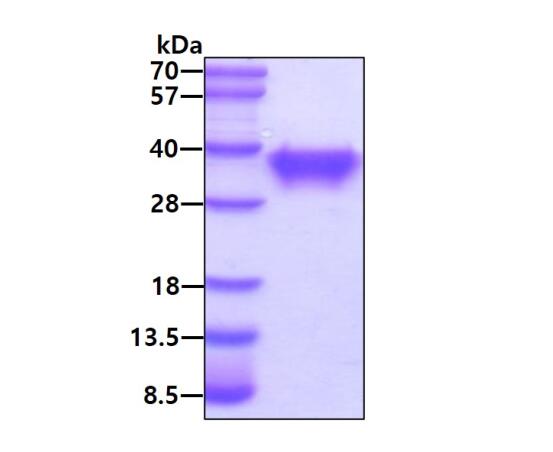 3 μg by SDS-PAGE under reducing condition and visualized by coomassie blue stain.